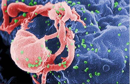 Crece esperanza contra el Sida: eliminan VIH de células humanas