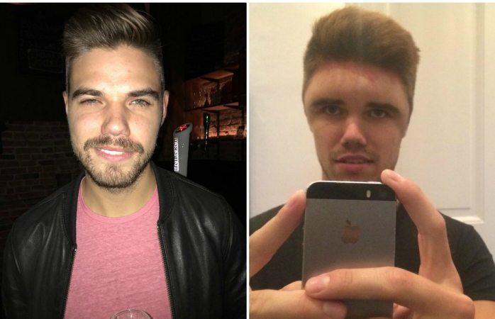 Se le deformó la cabeza tras pintarse el pelo