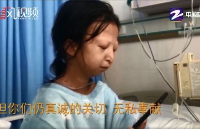 Muere joven china que se alimentó sólo de arroz y chiles durante 5 años