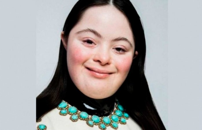 Ellie goldstein, la nueva modelo de gucci con síndrome de down