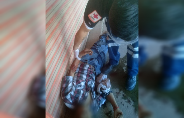 A mordidas, perro pitbull separa a rijosos