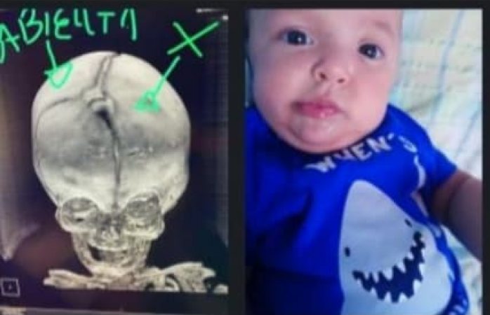 Piden apoyo para ayudar al pequeño samuel