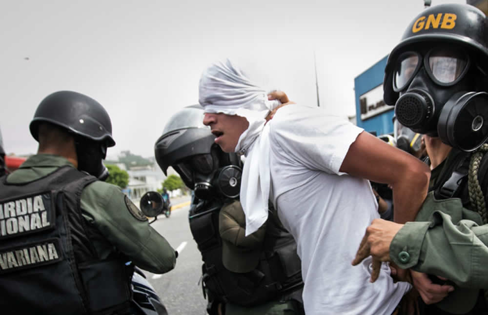 Golpes, mutilaciones y tortura psicológica han sufrido venezolanos 