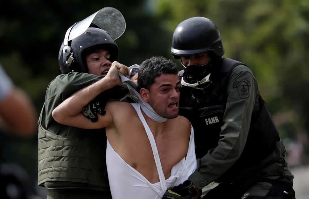 Golpes, mutilaciones y tortura psicológica han sufrido venezolanos 