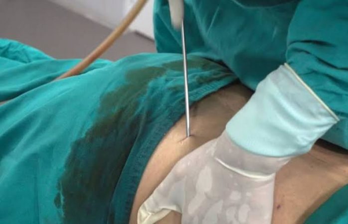 Muere joven tras liposucción en clínica irregular