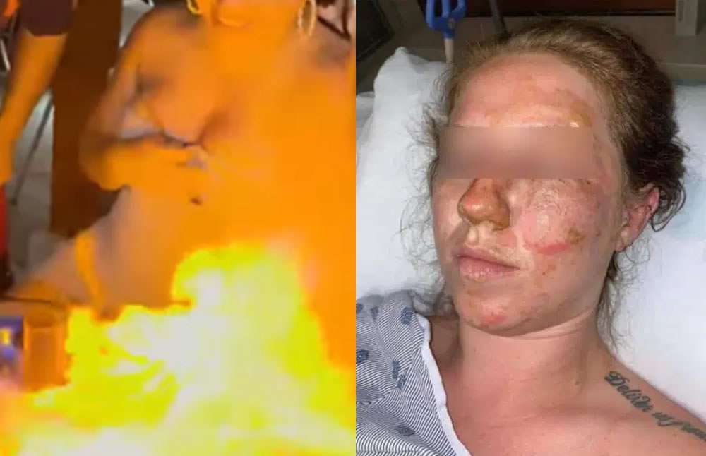 Mesero quema a turista cuando flameaba shot de cumpleaños 