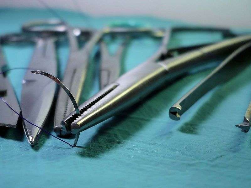 Vive mujer 20 años con tijeras en su abdomen tras cirugía