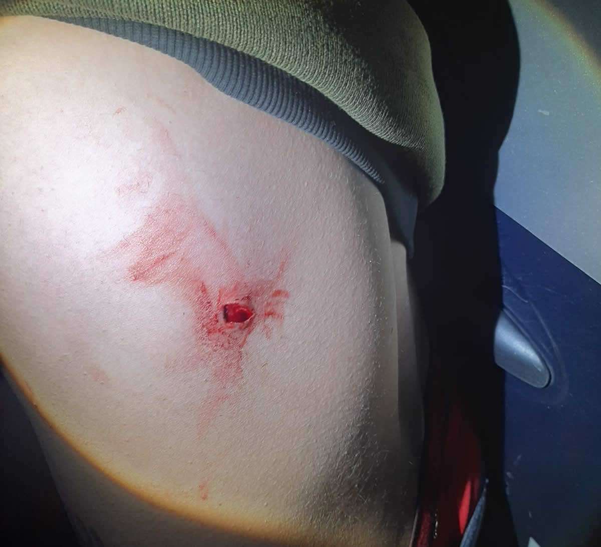 Lo marraneó con un cuchillo en vía pública