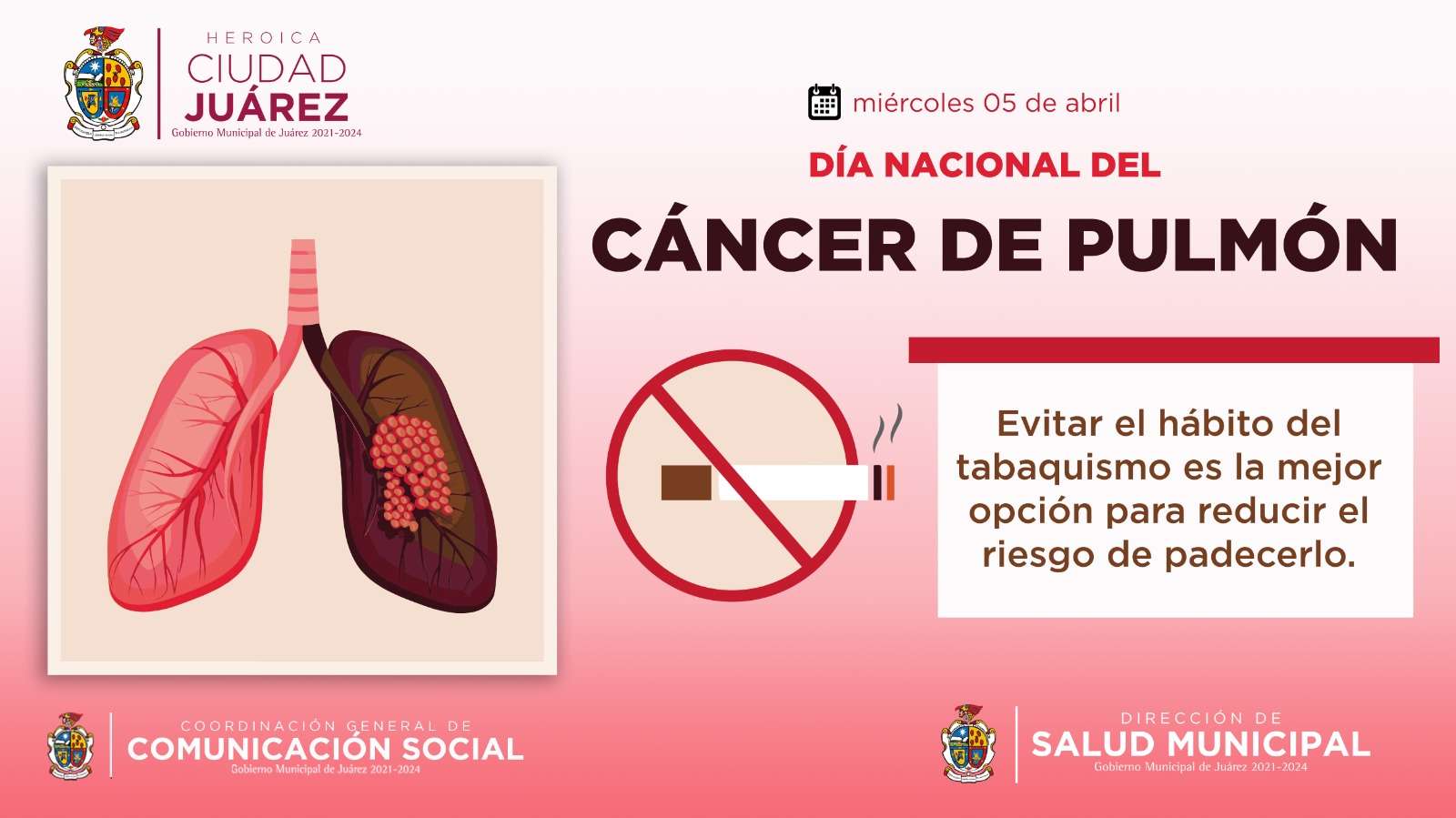 Este 5 de abril se conmemora el Día Nacional del Cáncer de Pulmón