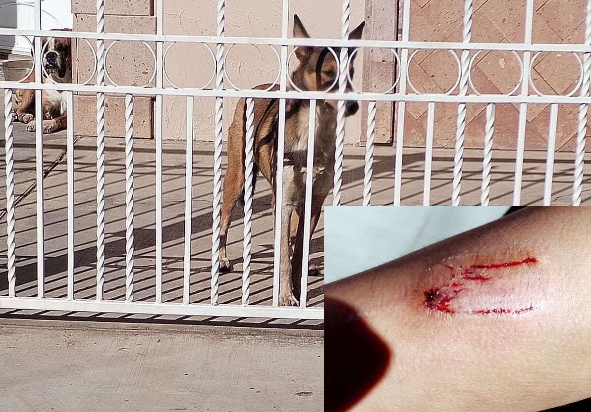 Ataca perro a un adolescente en Cuauhtémoc