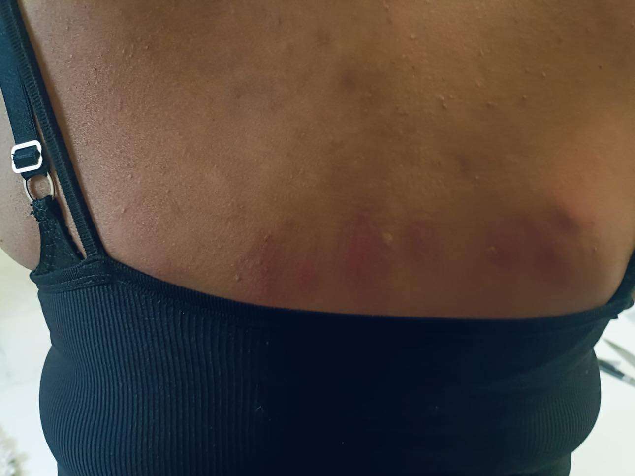 Denuncian plaga de chinches en oficinas de Infonavit | La Opción de ...