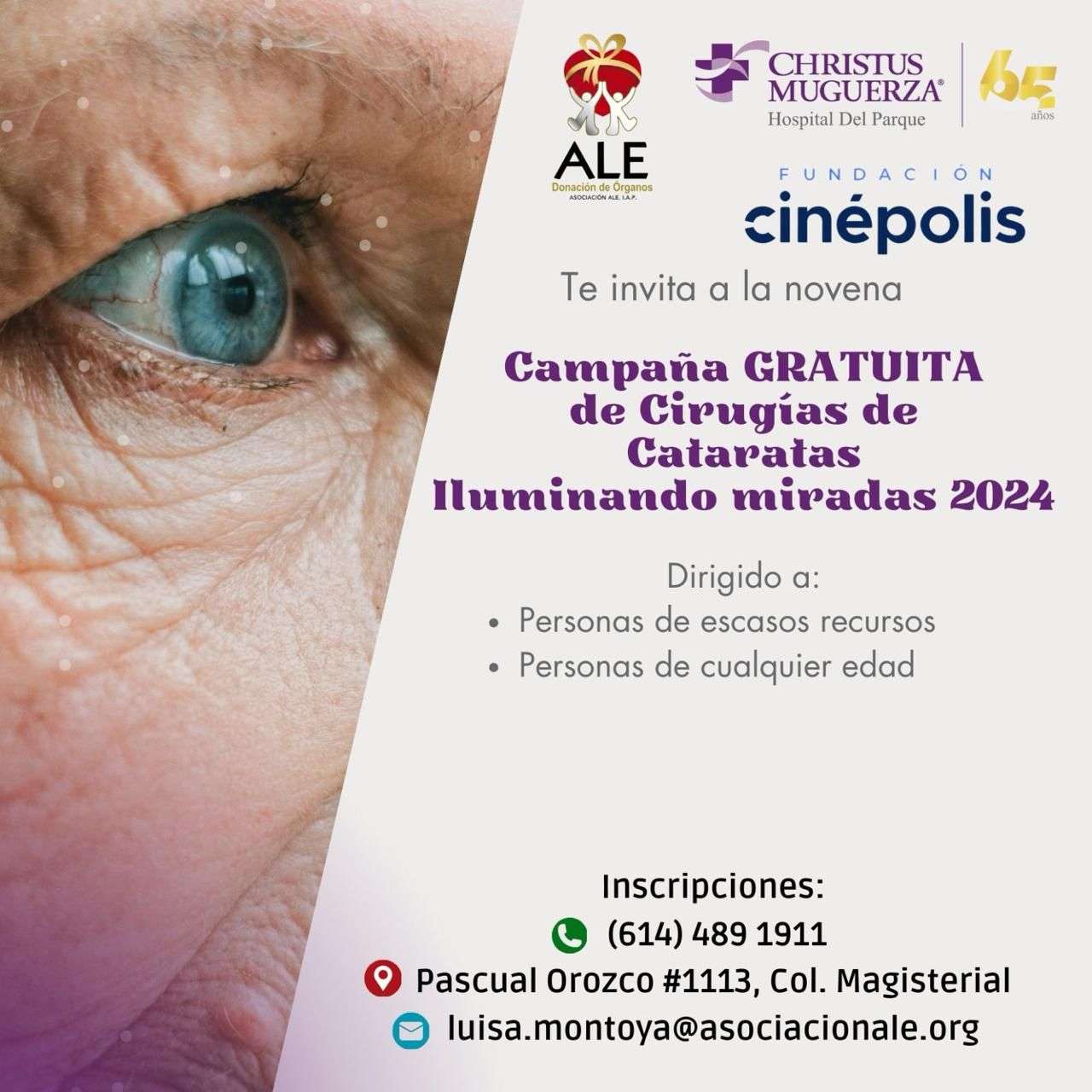 Invitan a campaña gratuita de cirugías de cataratas Iluminando Miradas