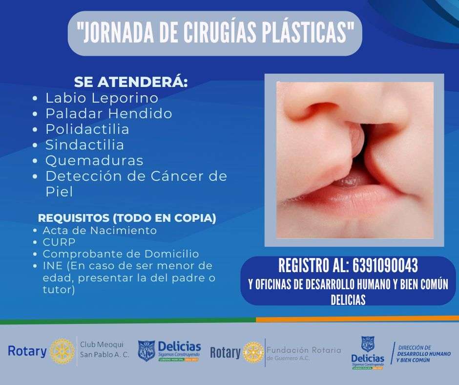 Invitan a Jornada de Cirugías Plásticas Gratuitas para Niños y Adultos
