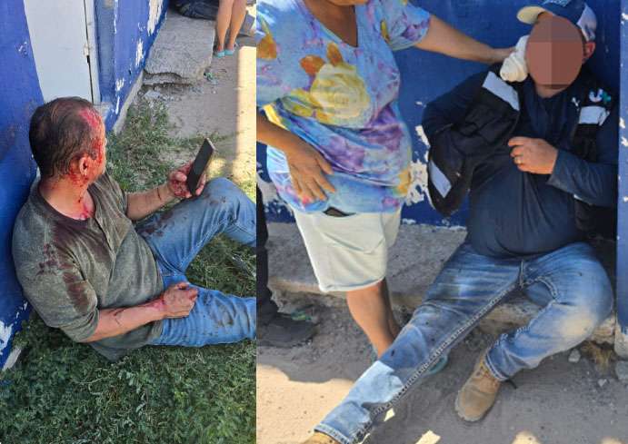 Riñen dos por un dinero y terminan heridos