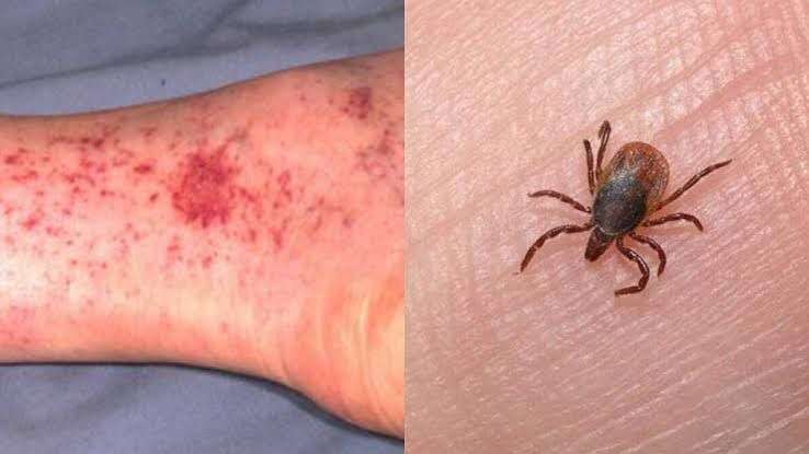 Reportan 20 casos y 8 muertes por rickettsiosis en Juárez 