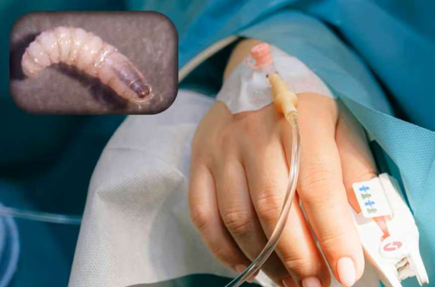 Detectan primer humano infectado de gusano barrenador en EU