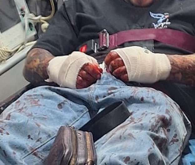 Lo balean en las manos afuera del Superette de Fovissste Chamizal