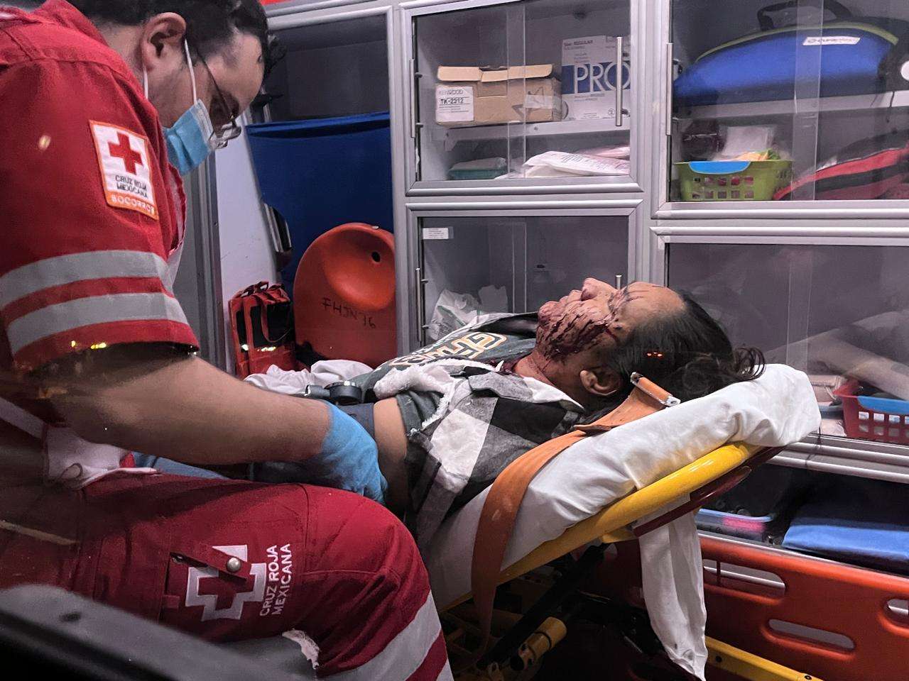 Omiten alto y chocan en la Panamericana; hay menores lesionados