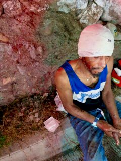 Golpean a uno en la cabeza con bate en la colonia Campesina