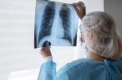 Van 400 casos de tuberculosis y 50 muertes en Chihuahua este año 