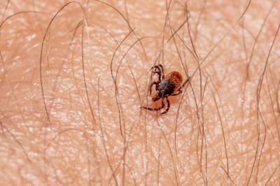 Lidera Chihuahua casos de rickettsiosis con 88 contagios y 38 muertes