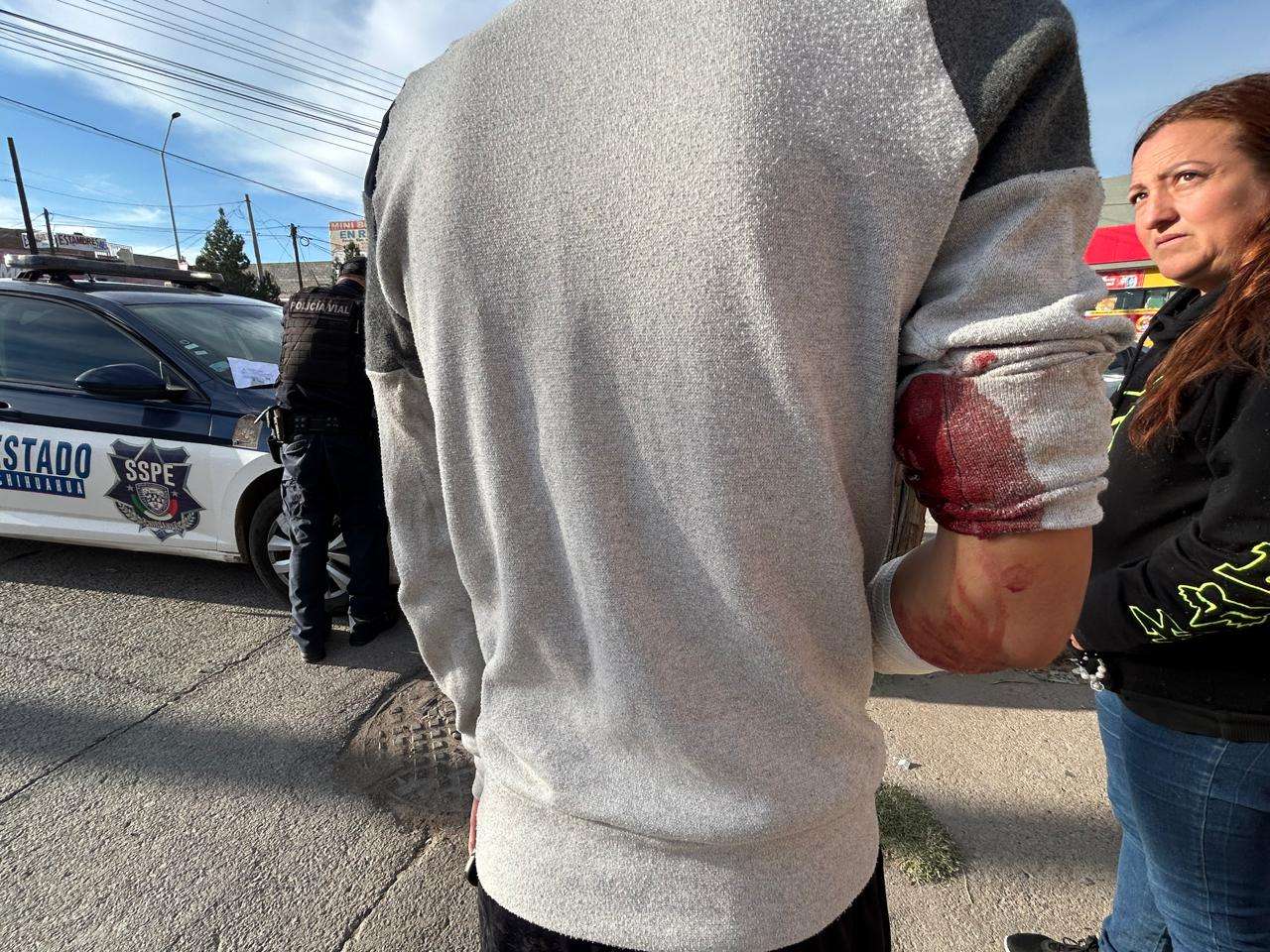 Resulta joven herido al ser arrollado en la colonia Cuarteles